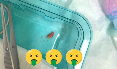 PICS: GAA player suffers gruesome injury, has opponent’s tooth pulled from his forehead