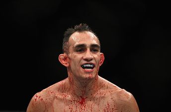 Tony Ferguson explains why he thinks he would beat Conor McGregor