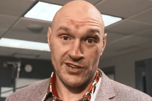 tyson fury helix