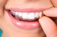 COMPETITION: Win invisible aligner dental treatment worth up to €1,799