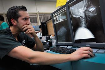 Young people are growing horns on their skulls due to using their phones too much