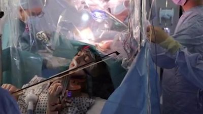 Woman plays violin while surgeons remove tumour from her brain