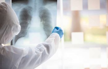 WHO says “the worst is yet to come” in relation to Covid-19