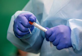 340 new cases of Covid-19 reported across Ireland