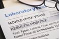 HSE team outlines potential symptoms of Monkeypox virus