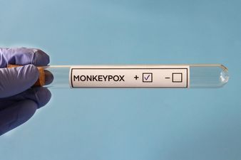 First confirmed case of monkeypox identified in Ireland