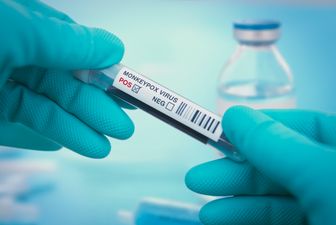 Second confirmed case of monkeypox identified in Ireland