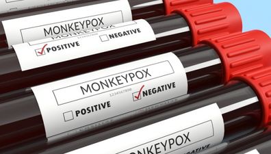 Monkeypox declared global health emergency by World Health Organisation