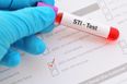 HSE announces launch of free home testing service for STIs