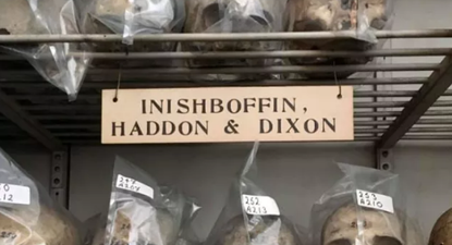 Trinity to return human skulls to Inishbofin and apologise for taking them without consent