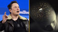 Elon Musk says his company has implanted a wireless chip in someone’s brain