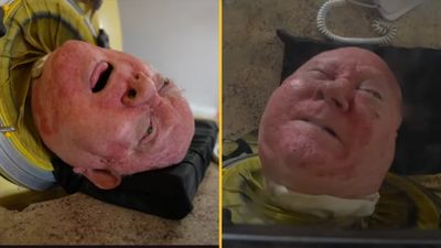 Man who lived inside iron lung learned new way of breathing