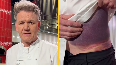 Gordon Ramsay says he’s ‘lucky to be alive’ after serious accident