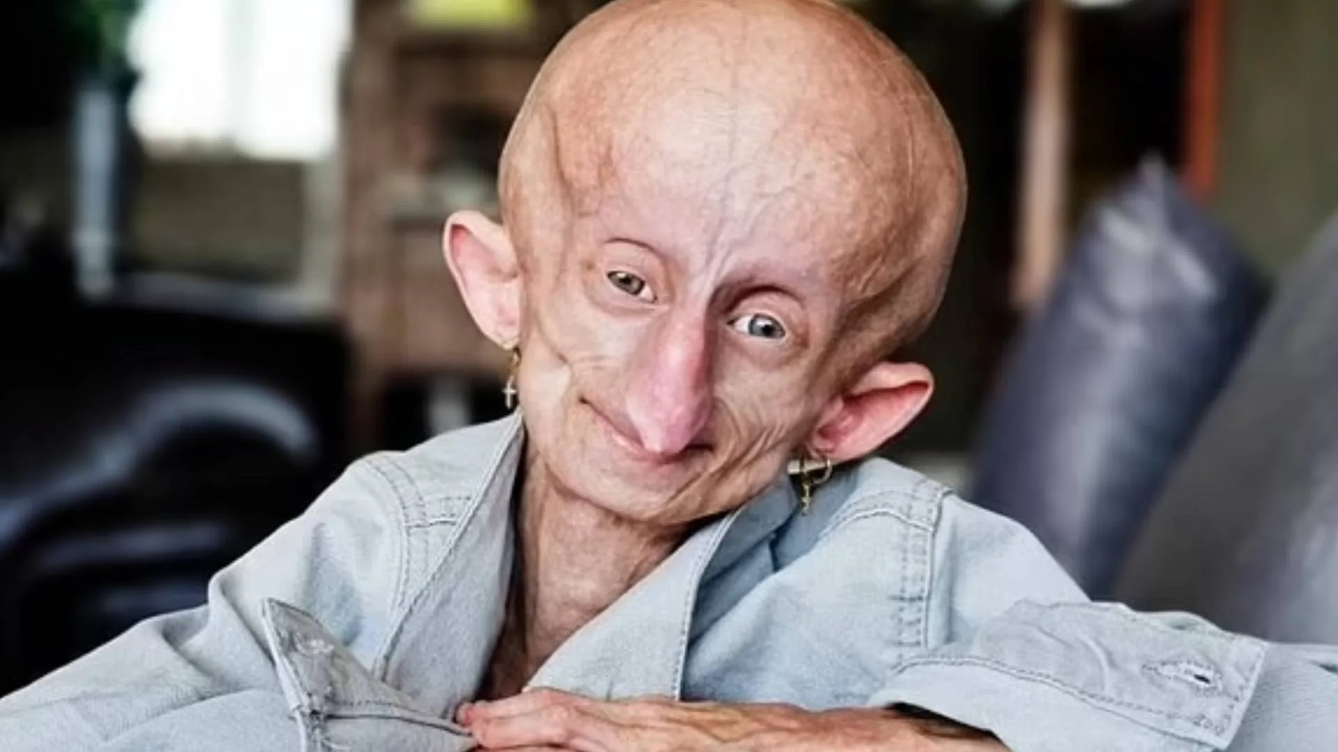 Inspirational TikTok star Beandri Booysen has died aged 19