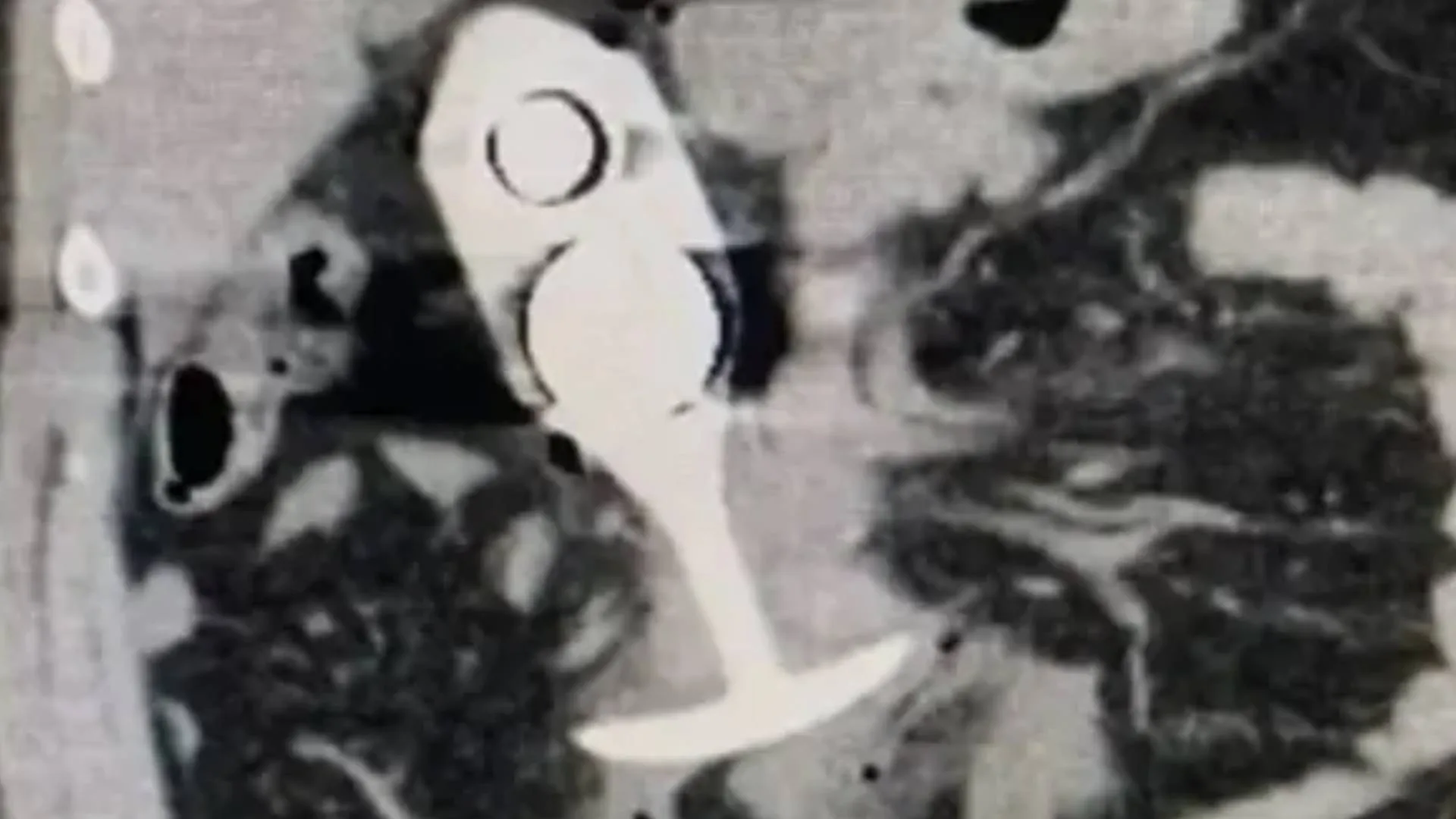 Woman left with horrific injuries after wearing sex toy to MRI scan